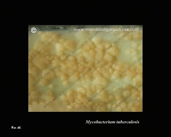 mycobacterium tuberculosis confluent growth